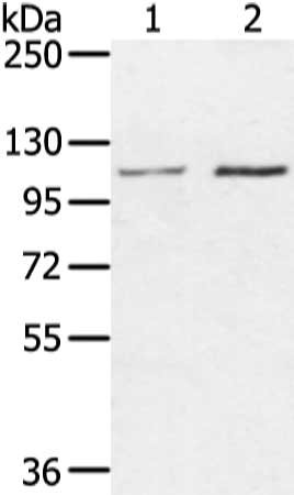Gel: 6%SDS-PAGE, Lysate: 40 μg, Lane 1-2: Hepg2 and hela cell, Primary antibody: MED16 Antibody(MED16 Antibody) at dilution 1/400 dilution, Secondary antibody: Goat anti rabbit IgG at 1/8000 dilution, Exposure time: 20 seconds