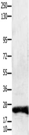 Gel: 10%SDS-PAGE, Lysate: 30 μg, Lane: Hela cells, Primary antibody: CLDN1 Antibody(CLDN1 Antibody) at dilution 1/1900, Secondary antibody: Goat anti rabbit IgG at 1/8000 dilution, Exposure time: 20 secondsRabbit anti-Human CLDN1 Polyclonal Antibody