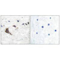 Immunohistochemical analysis of paraffin-embedded human brain tissue using ERAB antibody.Rabbit anti-Human HSD17B10 Polyclonal Antibody