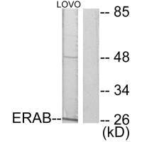 Western blot analysis of extracts from LOVO cells, using ERAB antibody.Rabbit anti-Human HSD17B10 Polyclonal Antibody