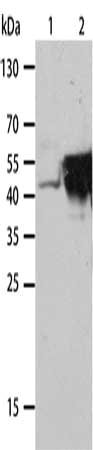 Gel: 12%SDS-PAGE, Lysate: 40 μg, Lane 1-2: Hela cells, lovo cells, Primary antibody: KRT19 Antibody(KRT19 Antibody) at dilution 1/1000, Secondary antibody: Goat anti rabbit IgG at 1/8000 dilution, Exposure time: 50 seconds