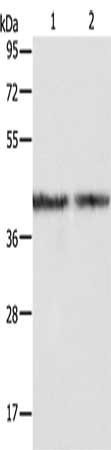 Gel: 10%SDS-PAGE, Lysate: 40 μg, Lane 1-2: A549 cells, hela cells, Primary antibody: ALDOA Antibody(ALDOA Antibody) at dilution 1/350, Secondary antibody: Goat anti rabbit IgG at 1/8000 dilution, Exposure time: 3 secondsRabbit anti-Human ALDOA Polyclonal Antibody