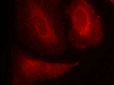 Immunofluorescence staining of methanol-fixed Hela cells using PDK1(Phospho-Ser241) Antibody.Rabbit anti-Human PDPK1 Polyclonal Antibody