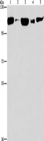 Gel: 6%SDS-PAGE, Lysate: 40 μg, Lane 1-5: Raji cells, human fetal liver tissue, NIH/3T3 cells, mouse brain tissue, hela cells, Primary antibody: DNM2 Antibody(DNM2 Antibody) at dilution 1/400, Secondary antibody: Goat anti rabbit IgG at 1/8000 dilution, Exposure time: 30 secondsRabbit anti-Human DNM2 Polyclonal Antibody