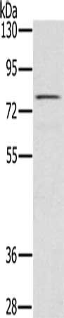 Gel: 6%SDS-PAGE, Lysate: 40 μg, Lane: Raw264.7 cells, Primary antibody: TAB3 Antibody(TAB3 Antibody) at dilution 1/500, Secondary antibody: Goat anti rabbit IgG at 1/8000 dilution, Exposure time: 10 secondsRabbit anti-Human TAB3 Polyclonal Antibody