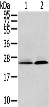 Gel: 12%SDS-PAGE,Lysate: 40 μg,Lane 1-2: Human fetal liver tissue, Hela cells,Primary antibody: ITPA Antibody(ITPA Antibody) at dilution 1/200 dilution,Secondary antibody: Goat anti rabbit IgG at 1/8000 dilution,Exposure time: 2 minutes
