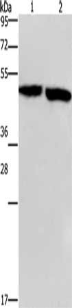 Gel: 8%SDS-PAGE, Lysate: 40 μg, Lane 1-2: Mouse stomach tissue, Mouse brain tissue, Primary antibody: CLUAP1 Antibody(CLUAP1 Antibody) at dilution 1/500, Secondary antibody: Goat anti rabbit IgG at 1/8000 dilution, Exposure time: 1 minuteRabbit anti-Human CLUAP1 Polyclonal Antibody