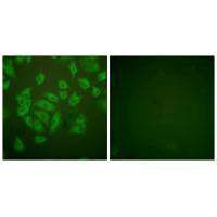 Immunofluorescence analysis of A549 cells, using Stefin A antibody.Rabbit anti-Human CSTA Polyclonal Antibody