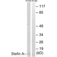 Western blot analysis of extracts from A549 cells, using Stefin A antibody.Rabbit anti-Human CSTA Polyclonal Antibody