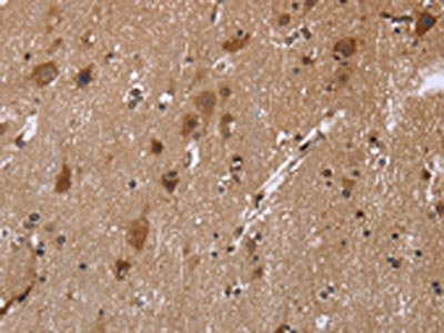 The image on the left is immunohistochemistry of paraffin-embedded Human brain tissue using the antibody Antibody) at dilution 1/30, on the right is treated with fusion protein. (Original magnification: ×200)Rabbit anti-Human REL Polyclonal Antibody