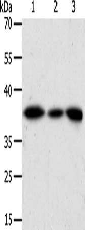 Gel: 10%SDS-PAGE, Lysate: 27 μg, Lane 1-3: Human liver cancer tissue, hela cells, human fetal kidney tissue, Primary antibody: AKR1A1 Antibody(AKR1A1 Antibody) at dilution 1/450, Secondary antibody: Goat anti rabbit IgG at 1/8000 dilution, Exposure time: 10 secondsRabbit anti-Human AKR1A1 Polyclonal Antibody
