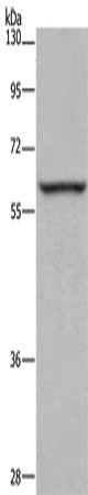 Gel: 8%SDS-PAGE, Lysate: 40 μg, Lane: Mouse brain tissue, Primary antibody: ESR2 Antibody(ESR2 Antibody) at dilution 1/250, Secondary antibody: Goat anti rabbit IgG at 1/8000 dilution, Exposure time: 10 secondsRabbit anti-Human ESR2 Polyclonal Antibody