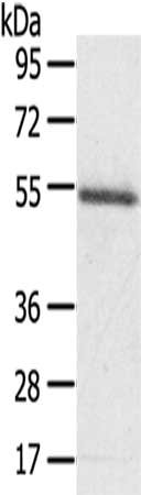Gel: 8%SDS-PAGE,Lysate: 40 μg,,Primary antibody: KCNG3 Antibody(KCNG3 Antibody) at dilution 1/200 dilution,Secondary antibody: Goat anti rabbit IgG at 1/8000 dilution,Exposure time: 30 secondsRabbit anti-Human KCNG3 Polyclonal Antibody