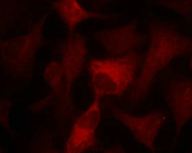 Immunofluorescence staining of methanol-fixed Hela cells using AMPKa1/AMPKa2(Ab-174/172) Antibody.Rabbit anti-Human PRKAA1 Polyclonal Antibody