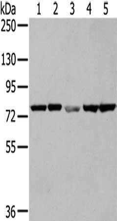 Gel: 6%SDS-PAGE,Lysate: 40 μg,Lane 1-5: Hela cells, A431 cells, Mouse skin tissue, MCF7 cells, K562 cells,Primary antibody: TGM5 Antibody(TGM5 Antibody) at dilution 1/250 dilution,Secondary antibody: Goat anti rabbit IgG at 1/8000 dilution,Exposure time: 1 minuteRabbit anti-Human TGM5 Polyclonal Antibody