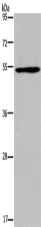 Gel: 8%SDS-PAGE, Lysate: 40 μg, Lane: A549 cells, Primary antibody: EPOR Antibody(EPOR Antibody) at dilution 1/500, Secondary antibody: Goat anti rabbit IgG at 1/8000 dilution, Exposure time: 40 secondsRabbit anti-Human EPOR Polyclonal Antibody