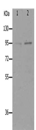 Gel: 10%SDS-PAGE, Lysate: 40 μg, Lane 1-2: HT29 cells, K562 cells, Primary antibody: LEPR Antibody(LEPR Antibody) at dilution 1/400, Secondary antibody: Goat anti rabbit IgG at 1/8000 dilution, Exposure time: 1 minute