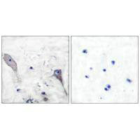 Immunohistochemical analysis of paraffin-embedded human brain tissue using Patched antibody.Rabbit anti-Human PTCH1 Polyclonal Antibody