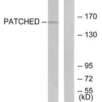 Western blot analysis of extracts from mouse muscle cells, using Patched antibody.Rabbit anti-Human PTCH1 Polyclonal Antibody