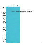 Western blot analysis of extracts from 3T3 cells (Lane 2) and HepG2 cells (Lane 3), using Patched antiobdy. The lane on the left is treated with synthesized peptide.Rabbit anti-Human PTCH1 Polyclonal Antibody