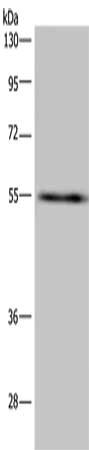 Gel: 8%SDS-PAGE, Lysate: 40 μg, Lane: A549 cells, Primary antibody: IMPDH2 Antibody(IMPDH2 Antibody) at dilution 1/650, Secondary antibody: Goat anti rabbit IgG at 1/8000 dilution, Exposure time: 3 minutesRabbit anti-Human IMPDH2 Polyclonal Antibody