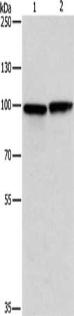 Gel: 6%SDS-PAGE, Lysate: 40 μg, Lane 1-2: Human testis tissue, U937 cells, Primary antibody: MSH5 Antibody(MSH5 Antibody) at dilution 1/200, Secondary antibody: Goat anti rabbit IgG at 1/8000 dilution, Exposure time: 5 secondsRabbit anti-Human MSH5 Polyclonal Antibody