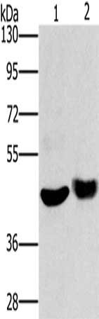 Gel: 8%SDS-PAGE, Lysate: 40 μg, Lane 1-2: Mouse muscle tissue, HT29 cells, Primary antibody: HTR3C Antibody(HTR3C Antibody) at dilution 1/650, Secondary antibody: Goat anti rabbit IgG at 1/8000 dilution, Exposure time: 30 secondsRabbit anti-Human HTR3C Polyclonal Antibody