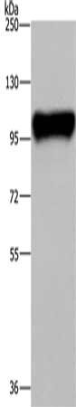 Gel: 6%SDS-PAGE, Lysate: 40 μg, Lane: Raji cells, Primary antibody: PTK2B Antibody(PTK2B Antibody) at dilution 1/300, Secondary antibody: Goat anti rabbit IgG at 1/8000 dilution, Exposure time: 1 minuteRabbit anti-Human PTK2B Polyclonal Antibody