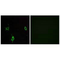 Immunofluorescence analysis of LOVO cells, using LAMC3 antibody.