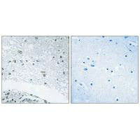 Immunohistochemistry analysis of paraffin-embedded human brain tissue using LAMC3 antibody.