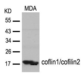 Western blot analysis of extracts from MDA cells using cofilin1/cofilin2(Ab-88) Antibody.Rabbit anti-Human CFL1/CFL2 Polyclonal Antibody