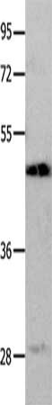 Gel: 10%SDS-PAGE, Lysate: 50 μg, Lane: Mouse liver tissue, Primary antibody: LYVE1 Antibody(LYVE1 Antibody) at dilution 1/300, Secondary antibody: Goat anti rabbit IgG at 1/8000 dilution, Exposure time: 20 seconds