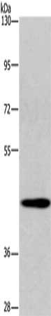 Gel: 6%SDS-PAGE, Lysate: 40 μg, Lane: Mouse liver tissue, Primary antibody: SGK2 Antibody(SGK2 Antibody) at dilution 1/200, Secondary antibody: Goat anti rabbit IgG at 1/8000 dilution, Exposure time: 20 secondsRabbit anti-Human SGK2 Polyclonal Antibody