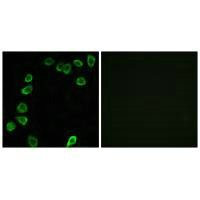 Immunofluorescence analysis of NIH/3T3 cells, using LAMA4 antibody.