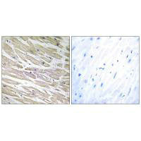Immunohistochemistry analysis of paraffin-embedded human heart tissue using LAMA4 antibody.