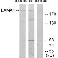 Western blot analysis of extracts from COLO cells and 293 cells, using LAMA4 antibody.