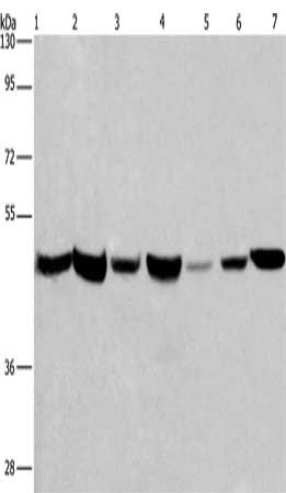 Gel: 8%SDS-PAGE, Lysate: 40 μg, Lane 1-7: Human placenta tissue, Human fetal liver tissue, PC3 cells, 231 cells, Hela cells, HepG2 cells, A549 cells, Primary antibody: APMAP Antibody(APMAP Antibody) at dilution 1/300, Secondary antibody: Goat anti rabbit IgG at 1/8000 dilution, Exposure time: 20 secondsRabbit anti-Human APMAP Polyclonal Antibody