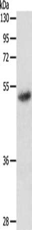 Gel: 10%SDS-PAGE, Lysate: 40 μg, Lane: Human fetal lung tissue, Primary antibody: RARA Antibody(RARA Antibody) at dilution 1/700, Secondary antibody: Goat anti rabbit IgG at 1/8000 dilution, Exposure time: 1 minuteRabbit anti-Human RARA Polyclonal Antibody