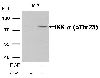 Western blot analysis of extracts from Hela cells, treated with EGF or calf intestinal phosphatase (CIP), using IKK α (Phospho-Thr23) Antibody.Rabbit anti-Human CHUK Polyclonal Antibody