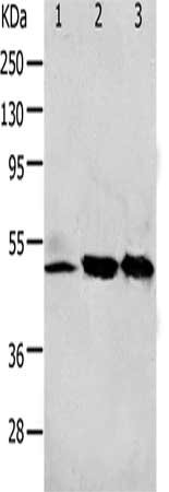 Gel: 10+12%SDS-PAGE, Lysate: 40 μg, Lane 1-3: 293T cells, K562 cells, human fetal kidney tissue, Primary antibody: F2R Antibody(F2R Antibody) at dilution 1/650, Secondary antibody: Goat anti rabbit IgG at 1/8000 dilution, Exposure time: 2 minutesRabbit anti-Human F2R Polyclonal Antibody