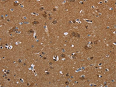 The image on the left is immunohistochemistry of paraffin-embedded Human brain  tissue using SLC22A2 Antibody(SLC22A2 Antibody) at dilution 1/30, on the right is treated with synthetic peptide. (Original magnification: ×200)Rabbit anti-Human SLC22A2 Polyclonal Antibody