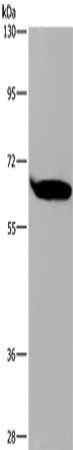 Gel: 6%SDS-PAGE, Lysate: 40 μg, Lane: 293T cells, Primary antibody: SLC22A2 Antibody(SLC22A2 Antibody) at dilution 1/200, Secondary antibody: Goat anti rabbit IgG at 1/8000 dilution, Exposure time: 20 secondsRabbit anti-Human SLC22A2 Polyclonal Antibody