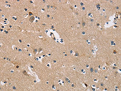 The image is immunohistochemistry of paraffin-embedded Human brain  tissue using AXIN2 Antibody(AXIN2 Antibody) at dilution 1/20. (Original magnification: ×200)