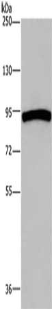 Gel: 8%SDS-PAGE, Lysate: 40 μg, Lane: Human ileum adenocarcinoma tissue, Primary antibody: AXIN2 Antibody(AXIN2 Antibody) at dilution 1/250, Secondary antibody: Goat anti rabbit IgG at 1/8000 dilution, Exposure time: 20 seconds