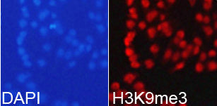Immunofluorescence analysis of 293T cell using  H3K9me3antibody. Blue: DAPI for nuclear staining.Rabbit anti-Human HIST3H3 Polyclonal Antibody