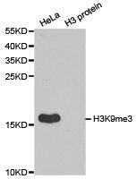 Western blot analysis of extracts of HeLa cell line and H3 protein expressed in E.coli., using H3K9me3 antibody.Rabbit anti-Human HIST3H3 Polyclonal Antibody