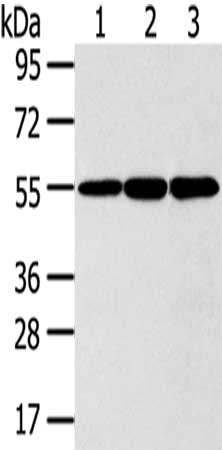 Gel: 8%SDS-PAGE,Lysate: 40 μg,Lane 1-3: 293T cells, LO2 cells, Lovo cells,Primary antibody: ISM2 Antibody(ISM2 Antibody) at dilution 1/300 dilution,Secondary antibody: Goat anti rabbit IgG at 1/8000 dilution,Exposure time: 5 seconds