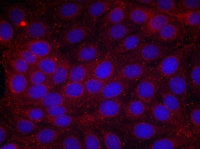Immunofluorescence staining of methanol-fixed MCF cells using VEGFR2(Phospho-Tyr1214) Antibody.