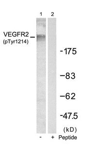 Western blot analysis of extracts from SKOV3 cells using VEGFR2(Phospho-Tyr1214) Antibody(Lane 1) and the same antibody preincubated with blocking peptide(Lane2).