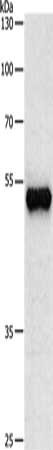 Gel: 8%SDS-PAGE, Lysate: 30 μg, Lane: Human brain glioma tissue, Primary antibody: TUBB3 Antibody(TUBB3 Antibody) at dilution 1/500, Secondary antibody: Goat anti rabbit IgG at 1/8000 dilution, Exposure time: 10 secondsRabbit anti-Human TUBB3 Polyclonal Antibody